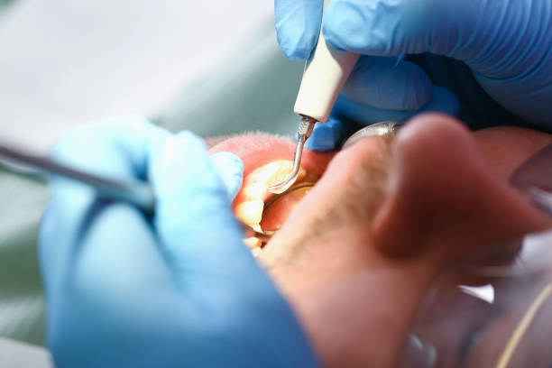 Tooth Infection Emergency Dentist in PA